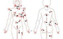 女性面部痣的类型和位置:女人眉下方的痣有何意义?女性桃花痣常生长在哪些部位?